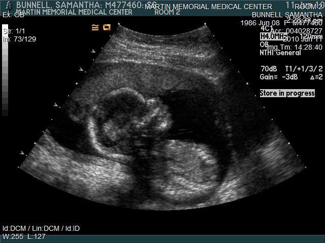 ultrasound0071.jpg picture by Rhyendel