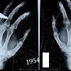 Xray4.jpg