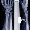 Xray5.jpg