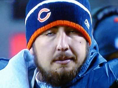 kyle-orton-stoned.jpg