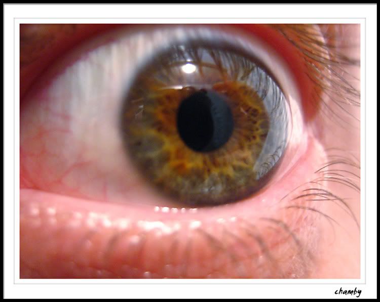 IMAGE: http://i25.photobucket.com/albums/c90/tellysurv/DPC_site/PAD_eyes.jpg