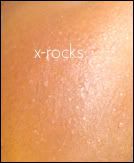 xrocks.jpg