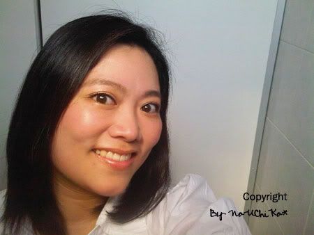 พอใจกับโรคมือ เท้า ปาก รถโดนชน